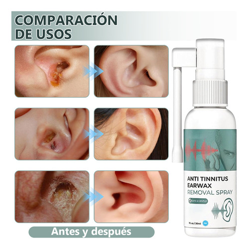 Oído Tinnitus Aliviar El Oído Gotas Tinnitus Sordera, 2 Unid