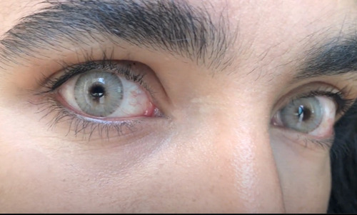 Imagen 9 de 10 de Urban Layer - Gogh N Brown Lentes De Contacto