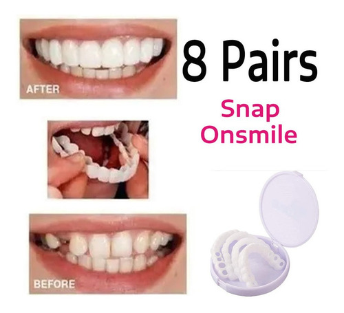 Sonrisa Blanqueamiento Oral Kit De - Unidad a $2430
