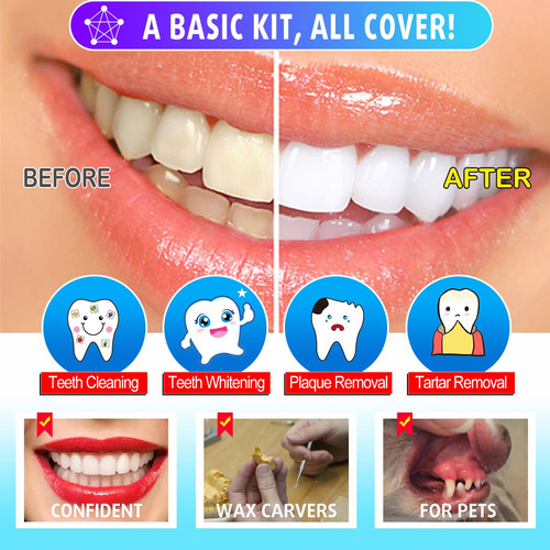 Juego De Dentista Simula Niños Regalo Navidad 13