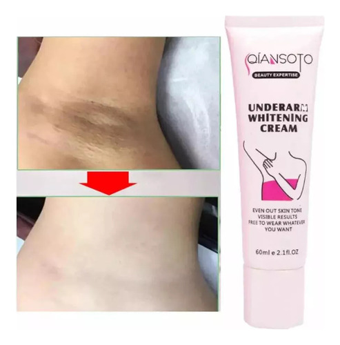 Crema Aclaradora De Axilas Partes Intimas Ano Entrepierna