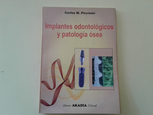 Implantes Odontologicos Y Patologia Osea - Piccinini