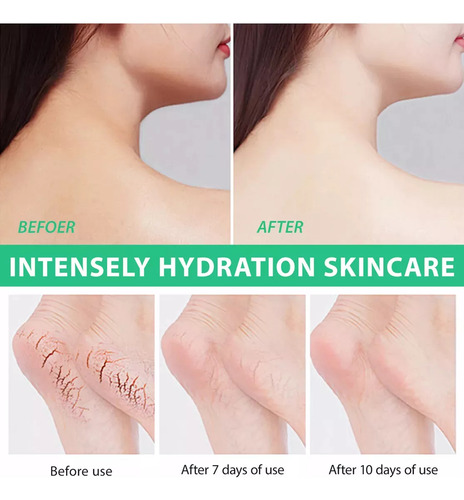 W Urea 40% Crema De Urea Cream Hidratante