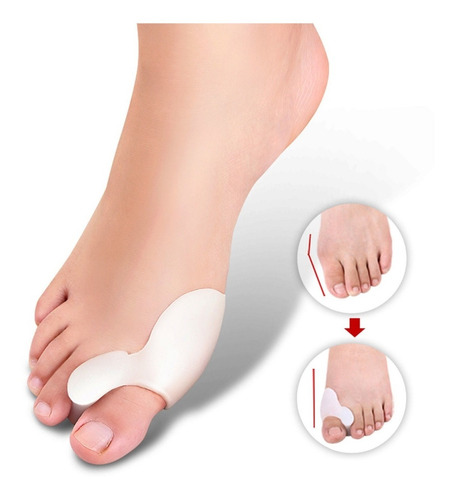 Corrector Juanetes, Separador Dedos Hallux Valgus Par Envío