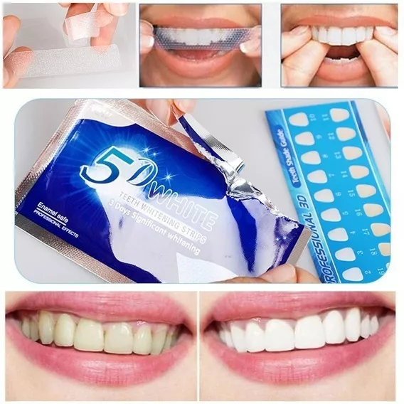 Terceira imagem para pesquisa de fita clareadora dental 5d