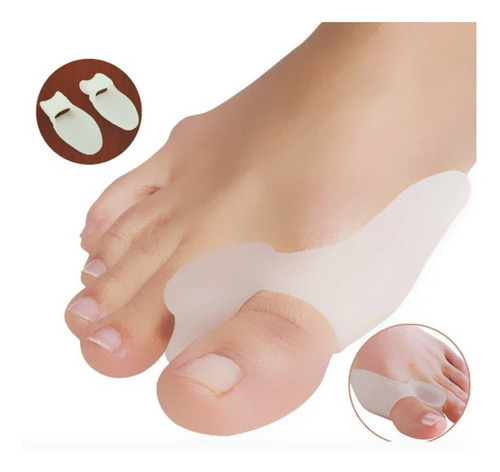 Corrector Para Juanetes Hallux Valgus (valor Por El Par)