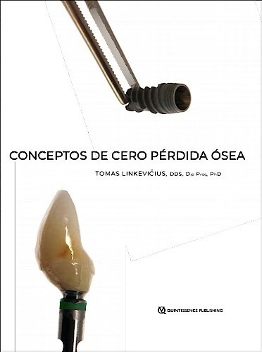 Conceptos De Cero Pérdida Ósea. Novedad En Español 