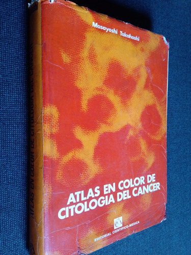 Atlas En Color De Citologia Del Cancer Masayoshi Takahashi