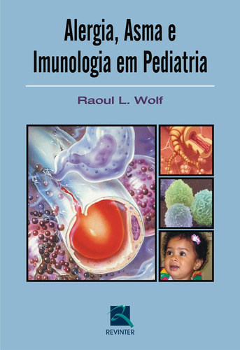 Alergia, Asma e Imunologia em Pediatria, de Wolf, Raoul L.. Editora Thieme Revinter Publicações Ltda, capa mole em português, 2008