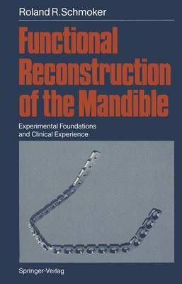 Libro Functional Reconstruction Of The Mandible : Experim...