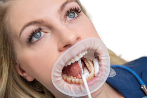 Optragate Ivoclar Regular Retractor Labios Mejillas 1pz