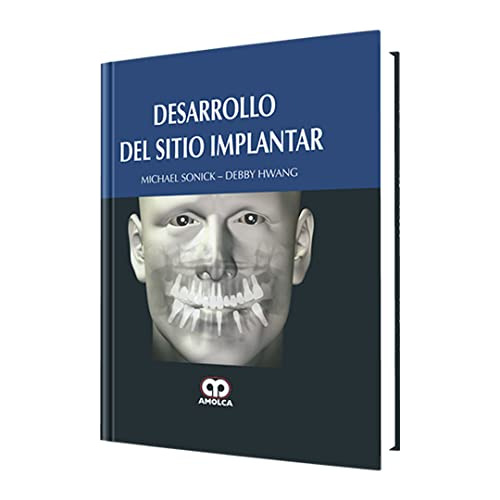 Libro Desarrollo Del Sitio Implantar De Michael Sonick, Debb