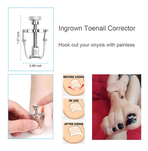 Upgraded 6pcs/set Ingrown Toenail Tools Kit, Premium Nail Tr