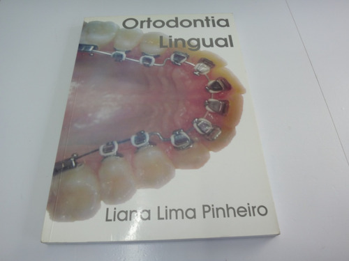 Livro Ortodontia Lingual - Liana Lima Pinheiro