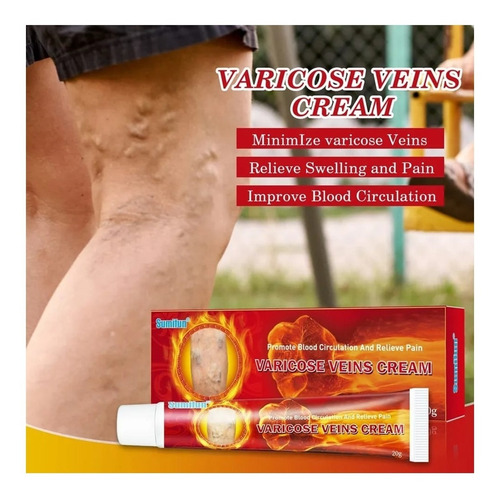 Sumifun - 2 Cremas Para Flebitis, Venas Varicosas, Varices