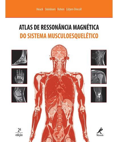 Atlas de ressonância magnética do sistema musculoesquelético, de Heuck, Andreas. Editora Manole LTDA, capa mole em português, 2012