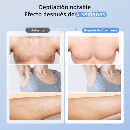 Depiladora Laser Permanente Ipl Modo Frio Sin Dolor 3 En 1 Blanco