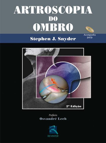 Libro Artroscopia Do Ombro 02ed 05 De Snyder Stephen J Thi