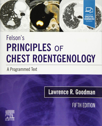 Felson´s Principles Of Chest Roentgenology A Programmed, de Goodman. Editorial ELSEVIER UK, tapa blanda en inglés, 2020