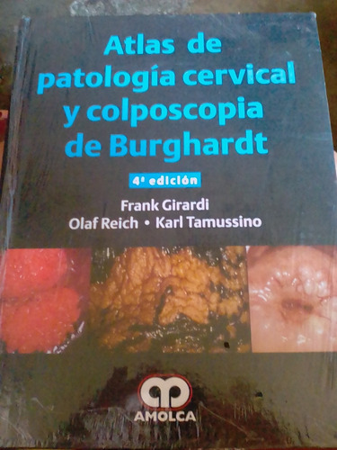 Atlas De Patología Cervical Y Colposcopia De Burghardt Amolc