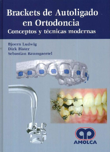 Libro Brackets De Autoligado En Ortodoncia De Bjoern Ludwig,