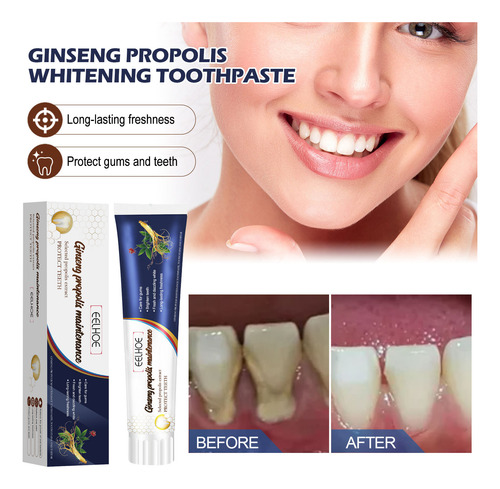 Clareamento De Própolis De Ginseng Como Dor Dentária, Dentes