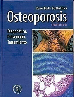 Osteoporosis. Diagnóstico, Prevención Y Tratamiento - Bartl