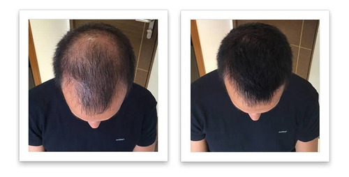 Imagen 4 de 6 de Amplixin Advanced Biotin Para El Crecimiento Del Cabello