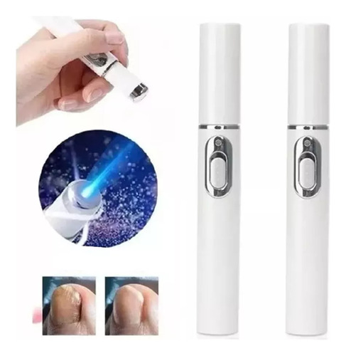 N Lápiz Láser Ligero Para Hongos En Las Uñas, 2 Unidades,