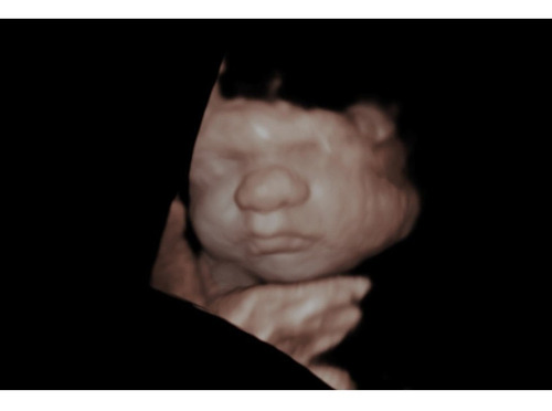 Imagen 2 de 5 de Ecografia 5d! Vas A Esperar 9 Meses Para Conocer A Tu Bebé?