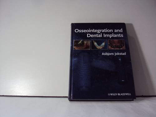 Oseointegration An Dental Implant Asborn Jokstad