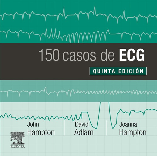 150 Casos De Ecg - Aa,vv