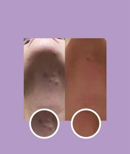 Imagen 9 de 9 de Crema Juveness Plus, Crema Para Mujer