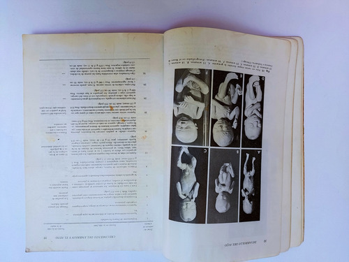 Libro Enfermeria Maternoinfantil Bleier 167a2 (Usado)