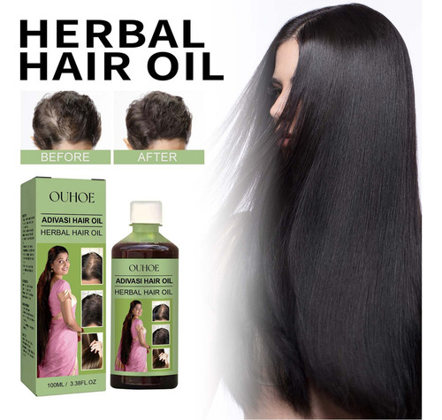 Aceite De Hierbas Para El Cabello De 100 Ml, Aceite Esencial