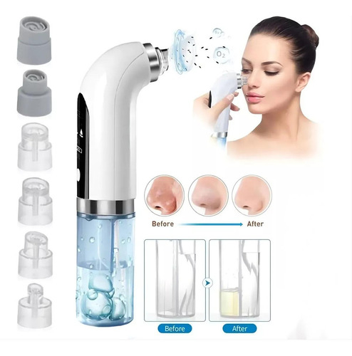 Bitina-kit De Belleza Usb Para Eliminar Puntos Negros Con Microlimpiador De Agua Y 6 Sondas, Extractor De Succión Eléctrico, Limpiador Facial Y 3 Niveles De Succión.