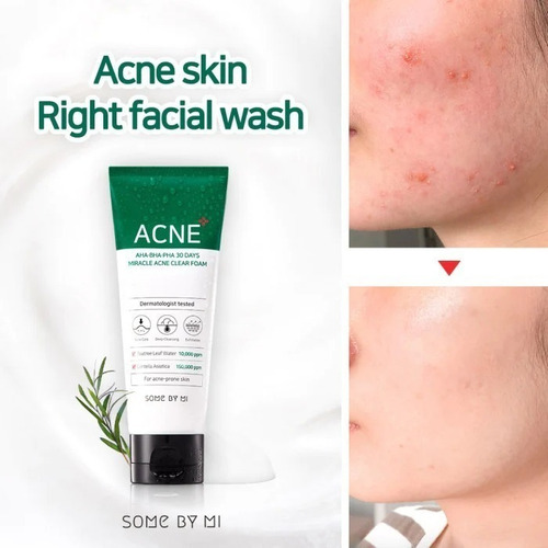 Some By Mi Miracle Acne Foam Espuma Limpiador Facial 100 Ml