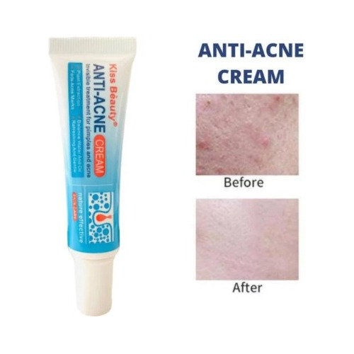 Crema Anti-acne Kiss Béauty 25g - g a $276
