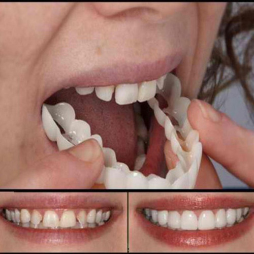Imagen 5 de 5 de Sonrisa Perfecta Dentadura Dientes Blancos Relucientes Minut