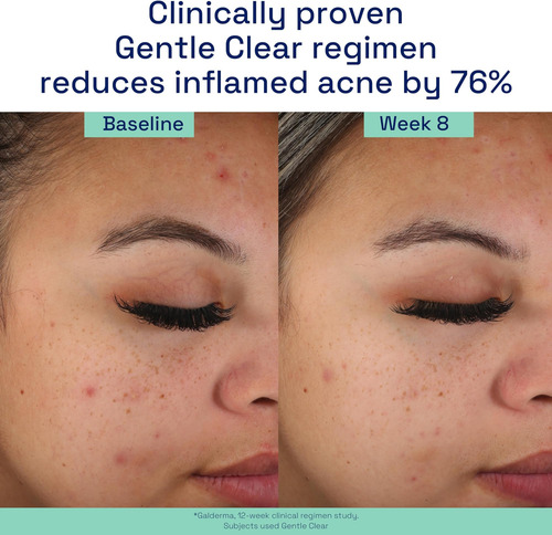 Hidratante Facial Cetaphil, Hidratante Suave E Matificante P