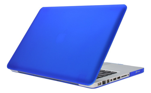 Carcasa Case Protector Para Macbook Pro 15 Model A1286
