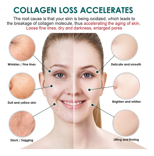 Creme Clareador Para Sardas, Melasma, Pigmentação De Manchas