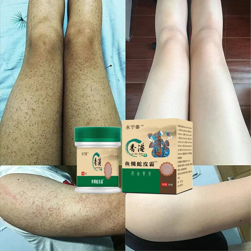 Crema Reparadora Y Removedora Para La Piel Corporal Con Trat