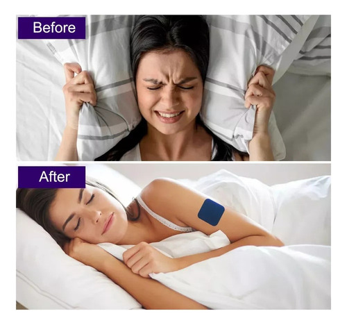 Pegatina Para Dormir, Ayuda Con El Insomnio Y Mejora El Sueñ