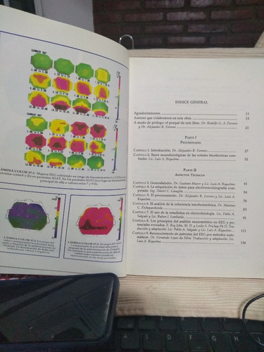 Análisis Computado Del Eeg - R. Ferrero, A. Ferrero (Usado)