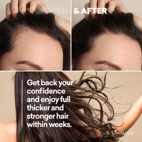 ChampĂș Para Crecer Cabello Nuevo | Crecimiento Saludable Del