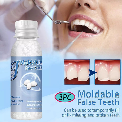 Q Reparación De Dientes Perlas Térmicas, Kit De Reparación