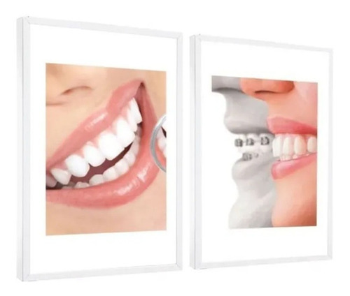 Quadro Decorativo Odontologia Sorrisos Dentes Moldura Branca