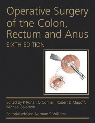 comprar Operative Surgery Of The Colon, Rectum And Anus - P. Ro&-.