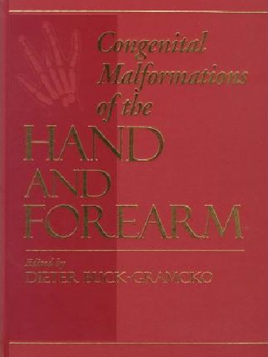 Congenital Malformations Of The Hand And Forearm
